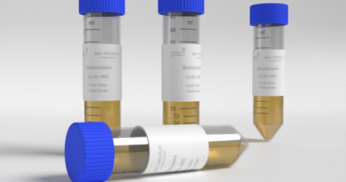 Lipemic Plasma: What It Is and Why It Matters in Laboratory Research